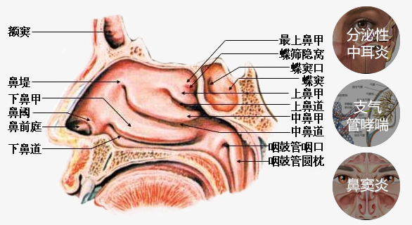 鼻部剖析图——鼻息肉